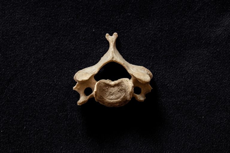 Foto de una vértebra sobre fondo negro